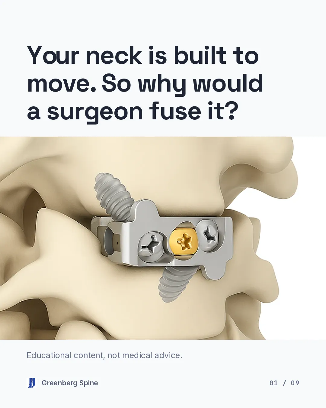 Carousel cover. The headline asks why the bones are fused after a worn disc is taken out of your neck. Beneath it, a full-width band from a three-dimensional illustration shows two neck vertebrae joined across the disc space by a small metal plate held with screws, including a gold central locking screw.